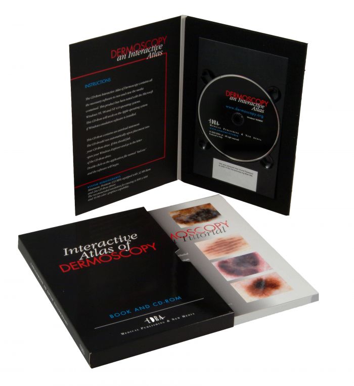 Interactive Atlas of Dermoscopy - Book & CD-ROM - (Single)